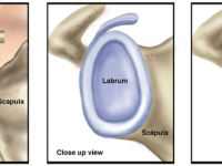 What is the Labrum Anyway?