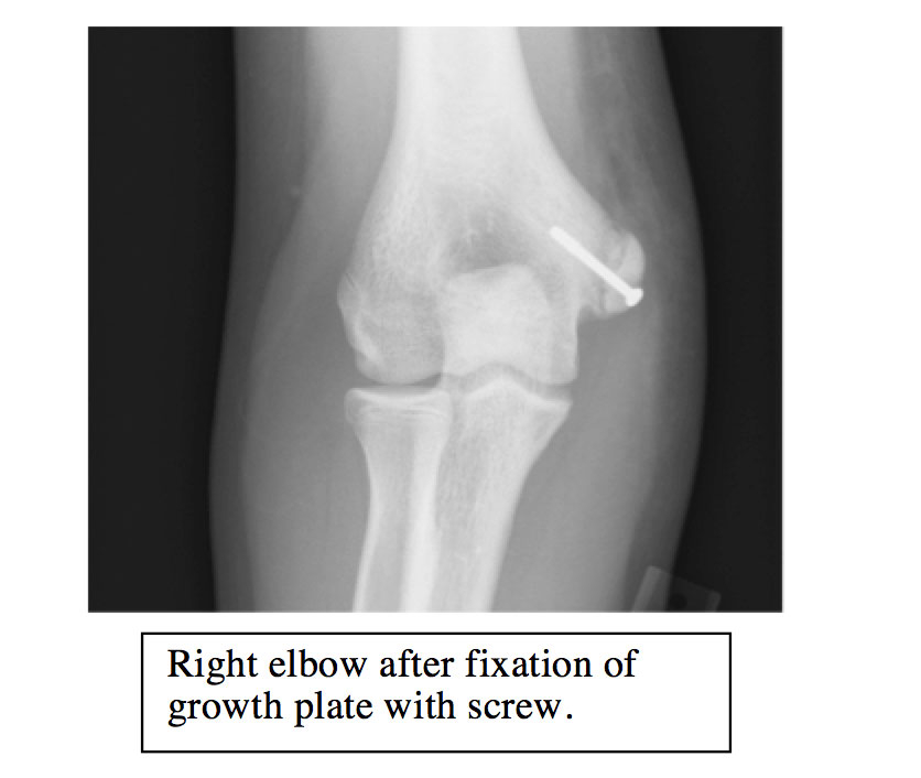 x ray pic 3